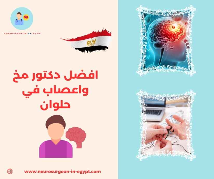 افضل دكتور مخ واعصاب في حلوان