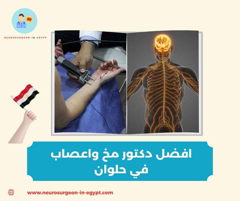 افضل دكتور مخ واعصاب في حلوان