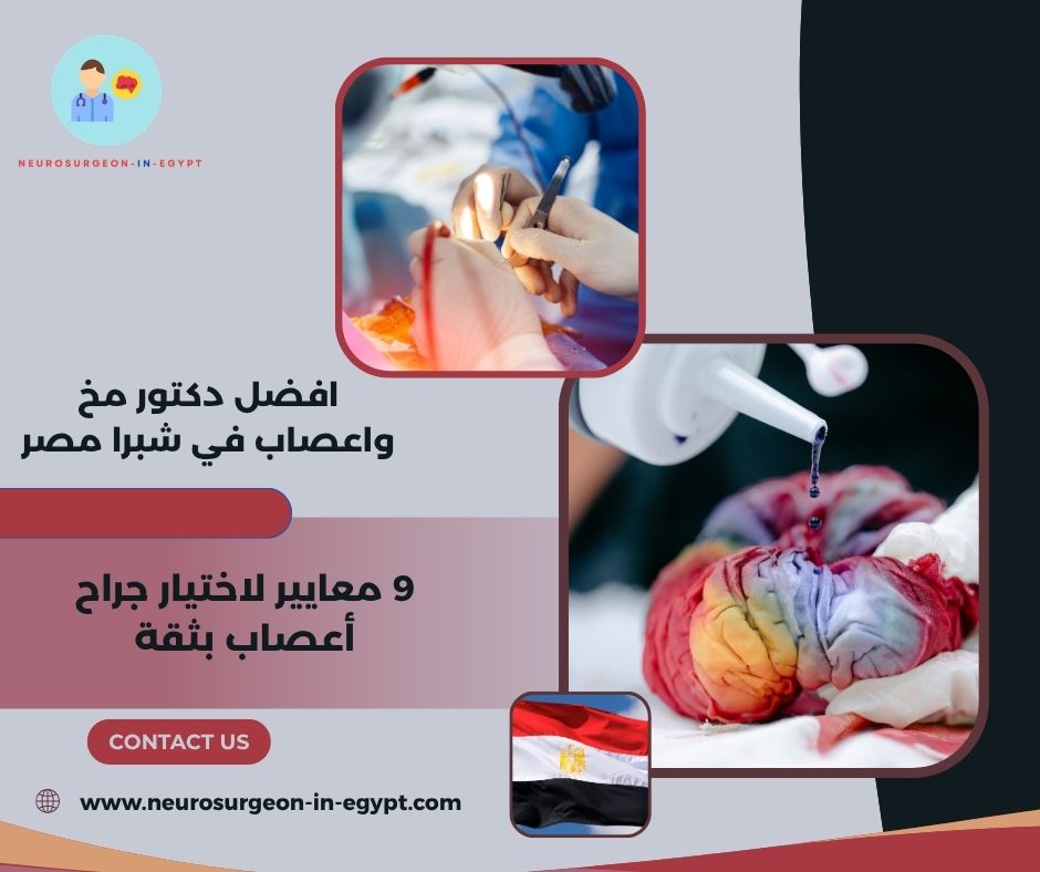 افضل دكتور مخ واعصاب في شبرا مصر