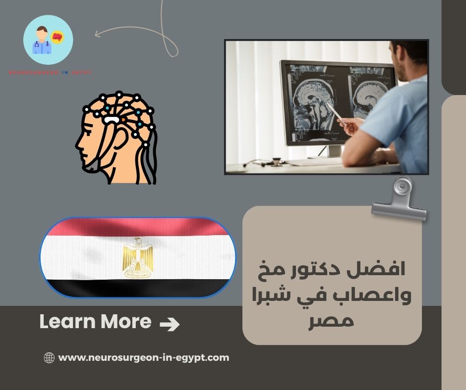 افضل دكتور مخ واعصاب في شبرا مصر