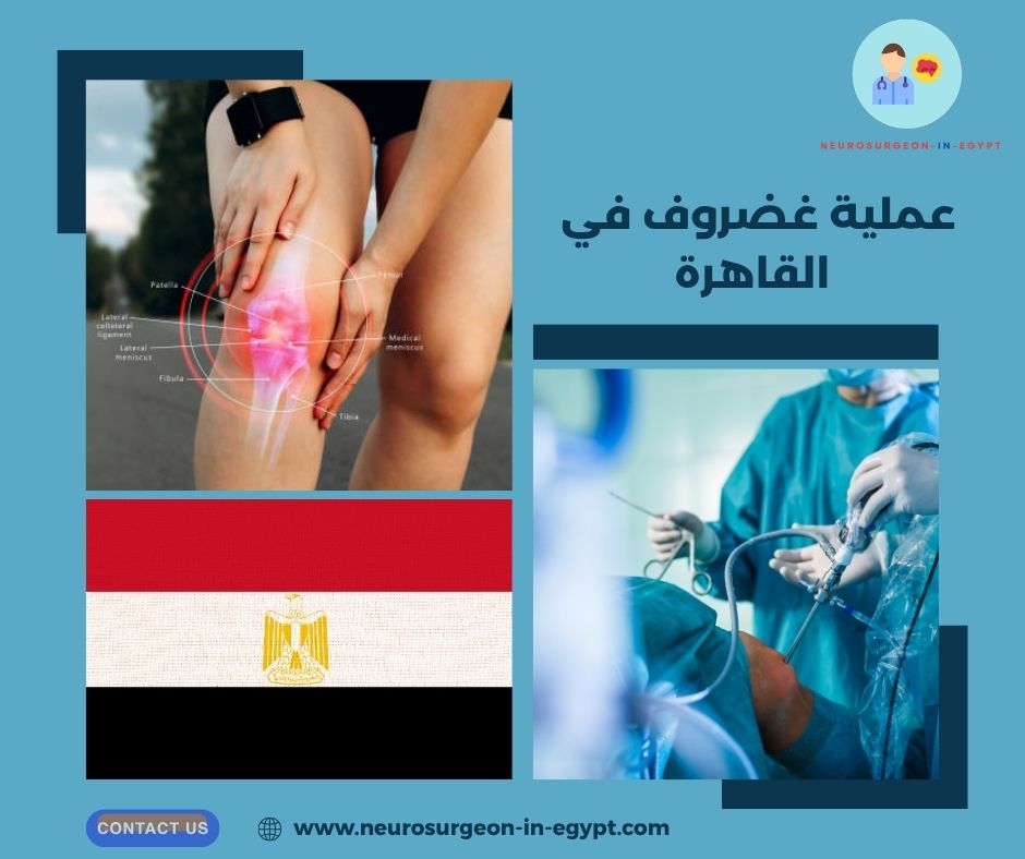 عملية غضروف في القاهرة