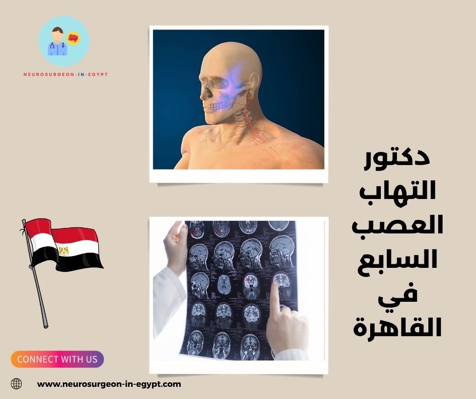 دكتور التهاب العصب السابع في القاهرة