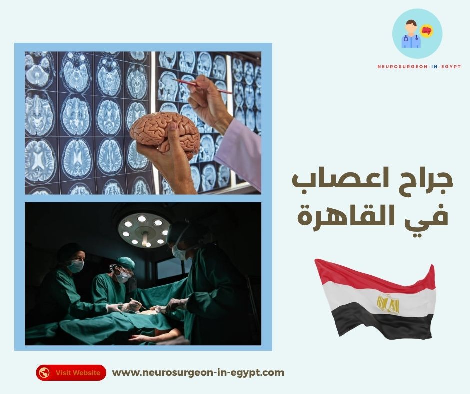 جراح اعصاب في القاهرة