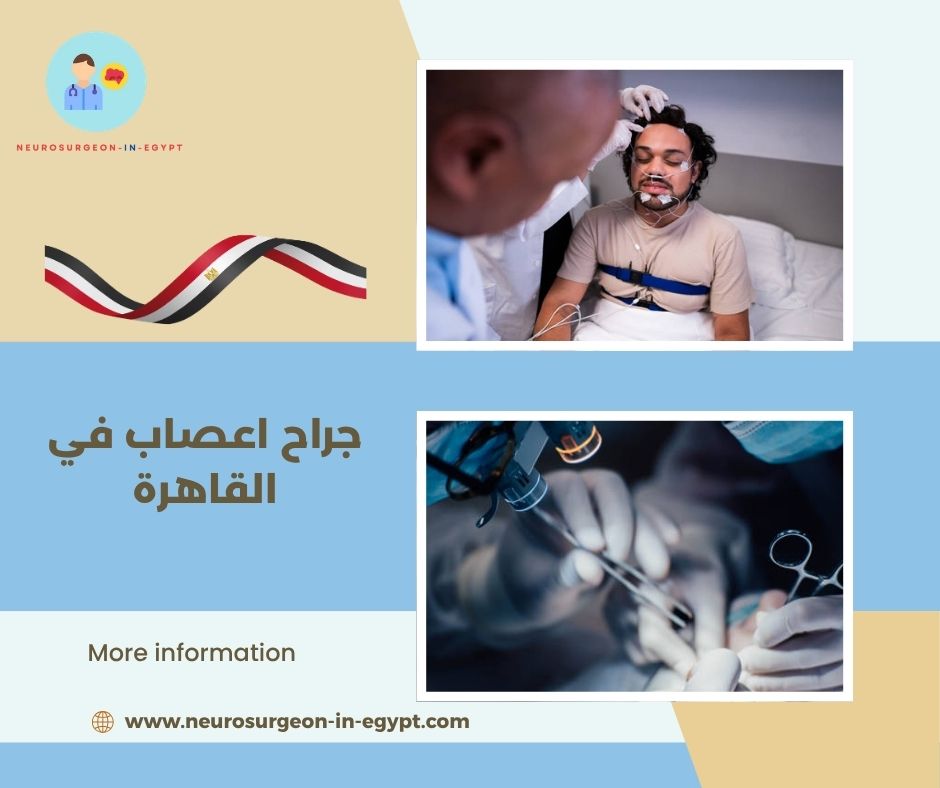 جراح اعصاب في القاهرة
