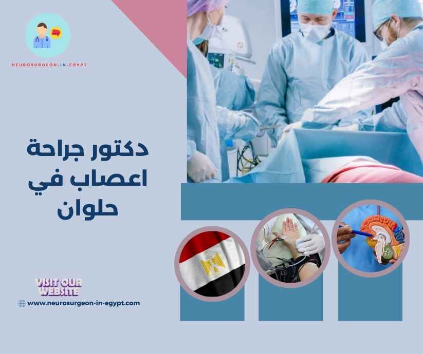 دكتور جراحة اعصاب في حلوان