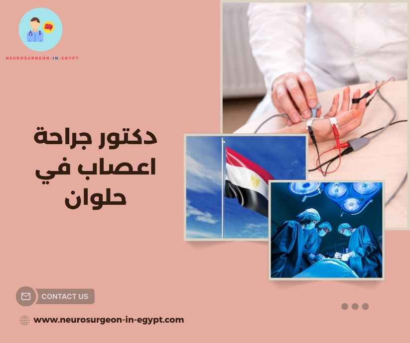 دكتور جراحة اعصاب في حلوان