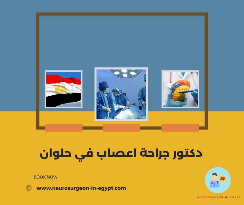 دكتور جراحة اعصاب في حلوان