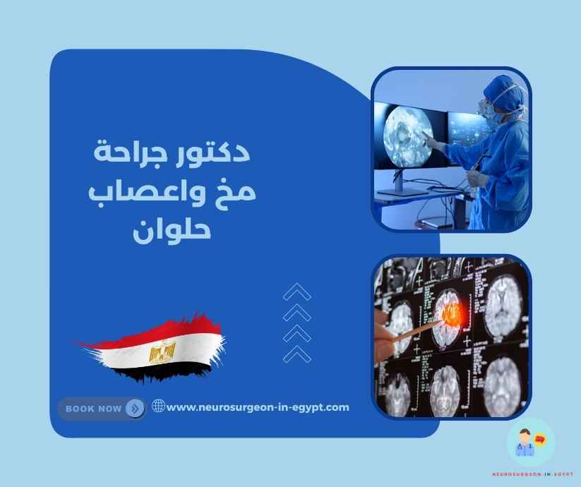 دكتور جراحة مخ واعصاب حلوان