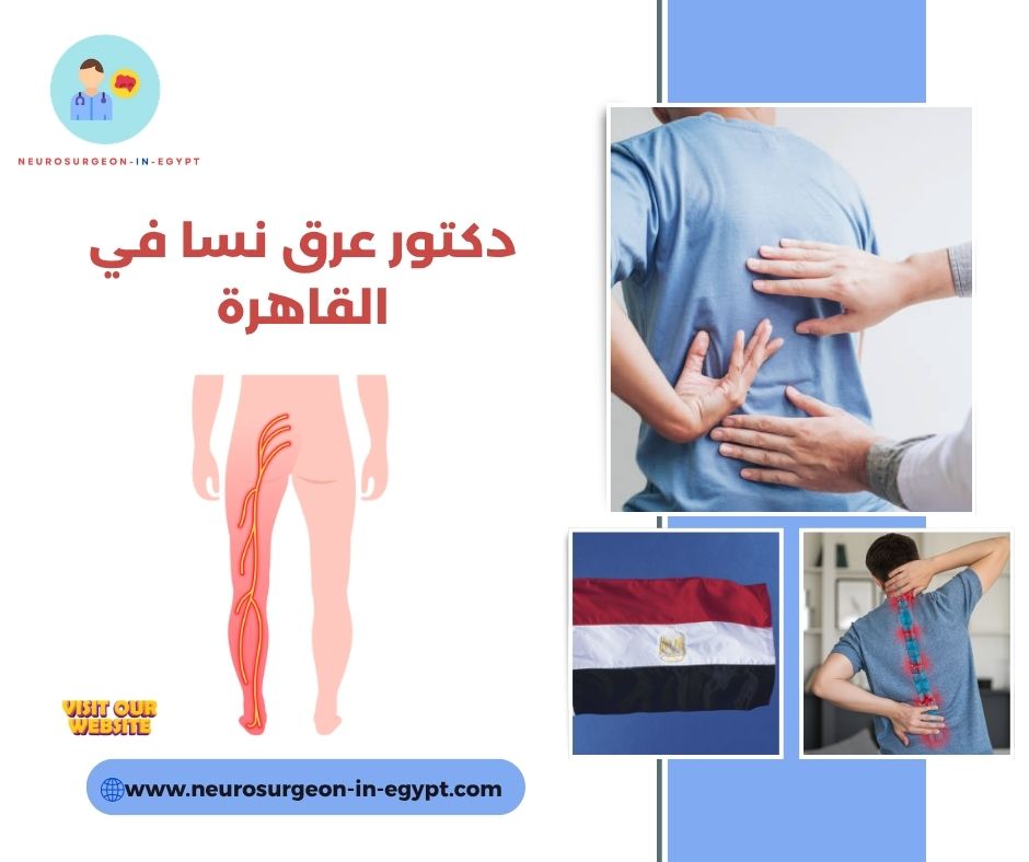 دكتور عرق نسا في القاهرة