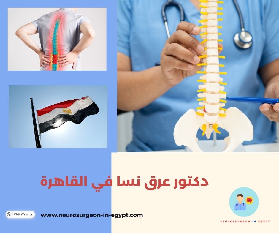 دكتور عرق نسا في القاهرة