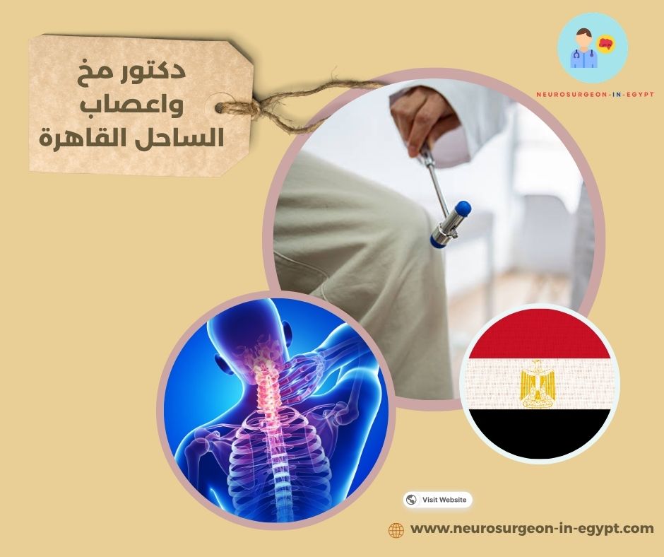 دكتور مخ واعصاب الساحل القاهرة