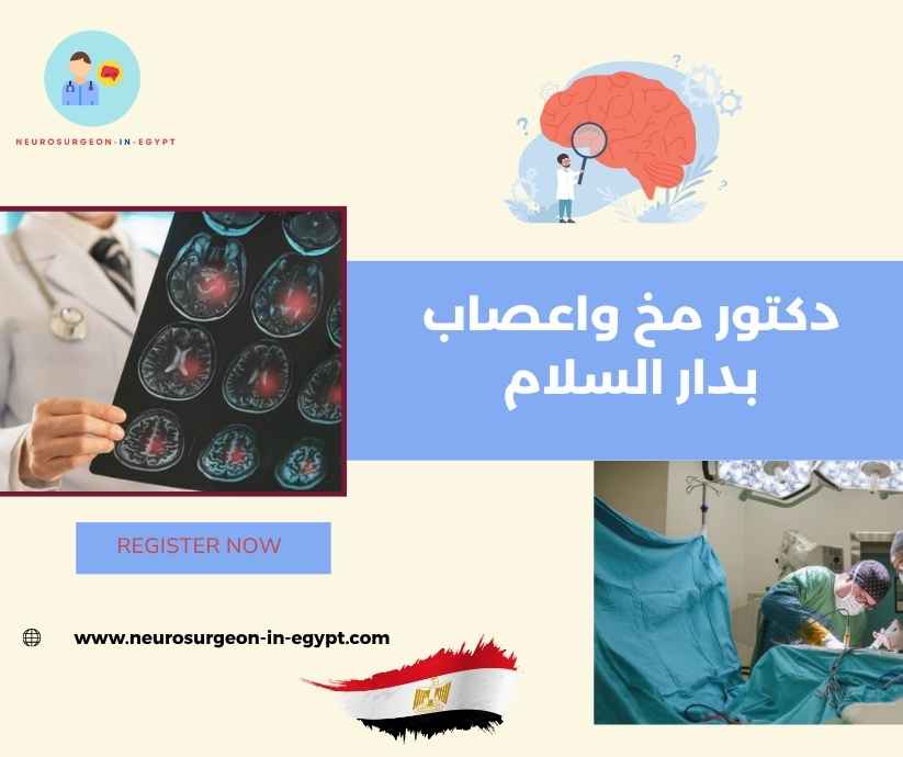 دكتور مخ واعصاب بدار السلام