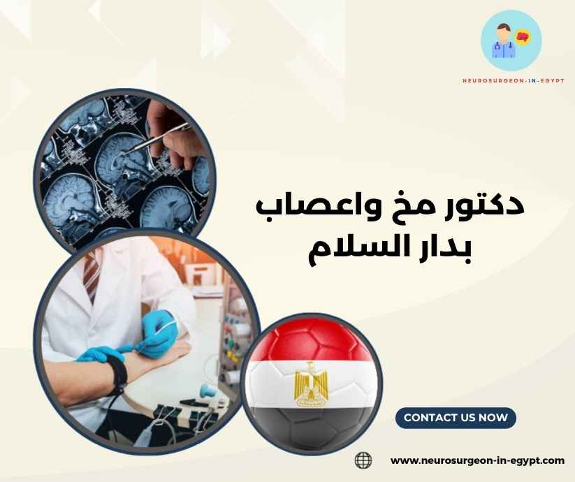 دكتور مخ واعصاب بدار السلام