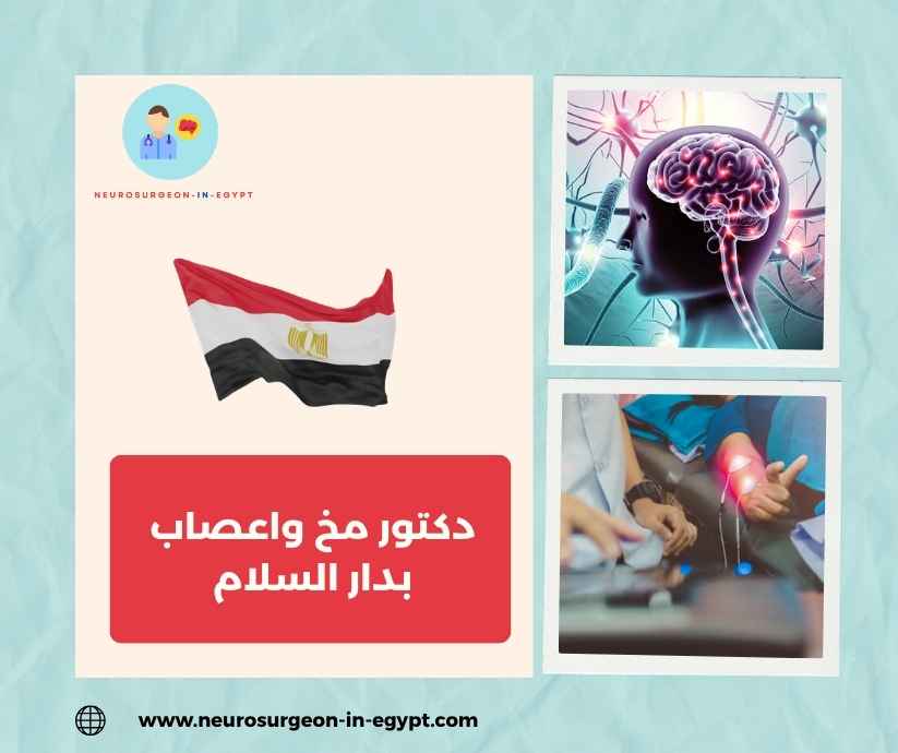 دكتور مخ واعصاب بدار السلام