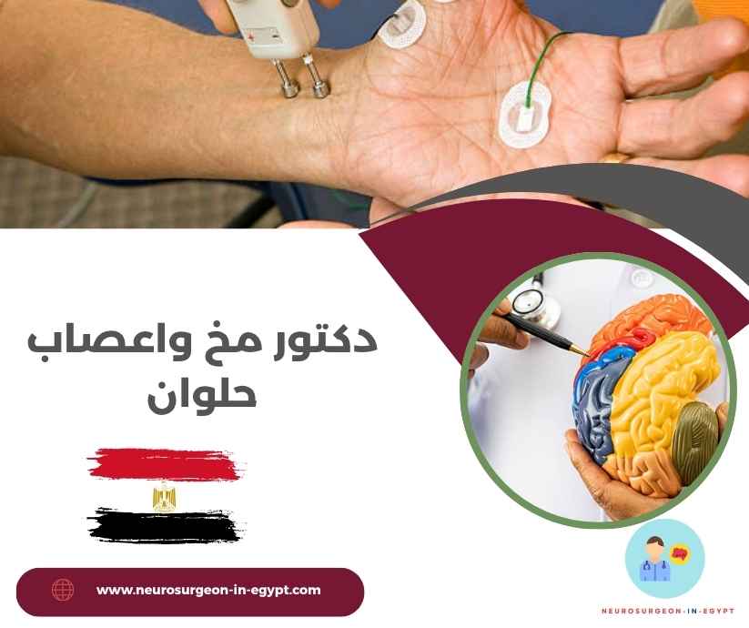 دكتور مخ واعصاب حلوان