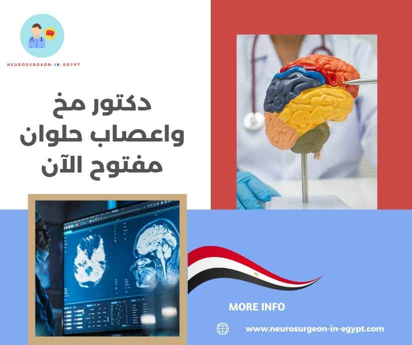 دكتور مخ واعصاب حلوان مفتوح الآن