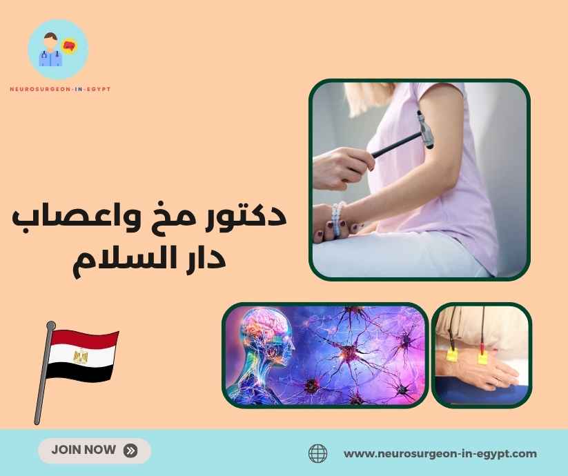 دكتور مخ واعصاب دار السلام