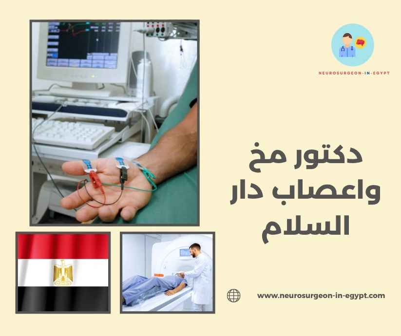 دكتور مخ واعصاب دار السلام