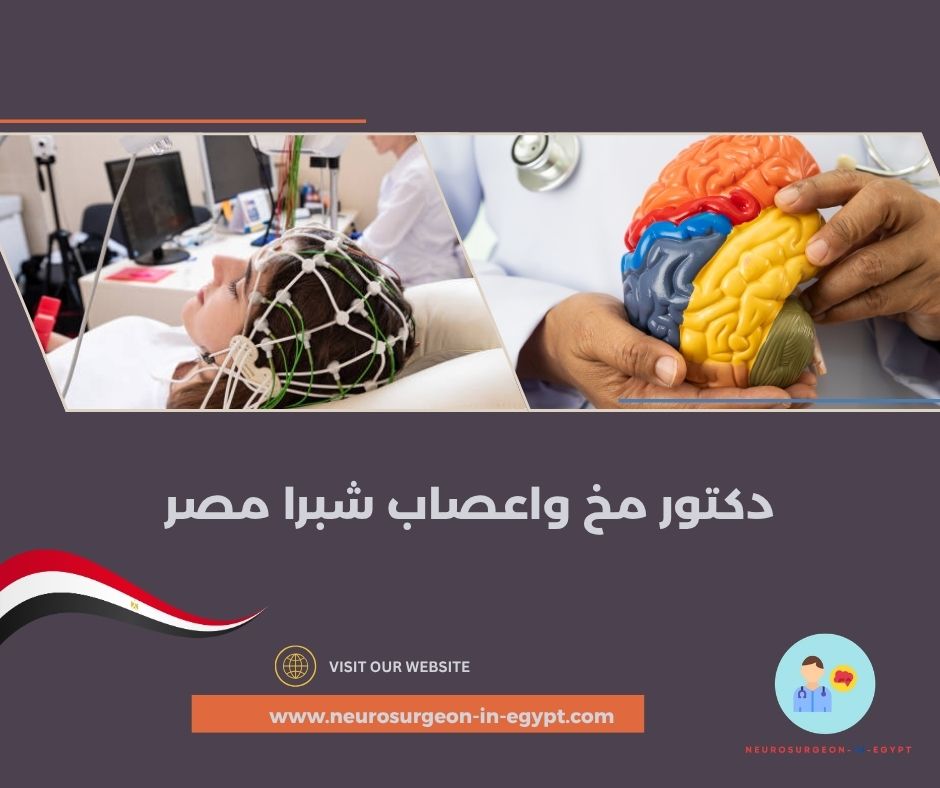 دكتور مخ واعصاب شبرا مصر
