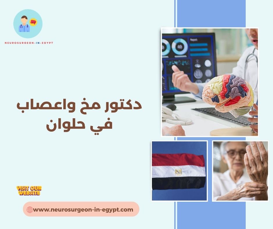 دكتور مخ واعصاب في حلوان