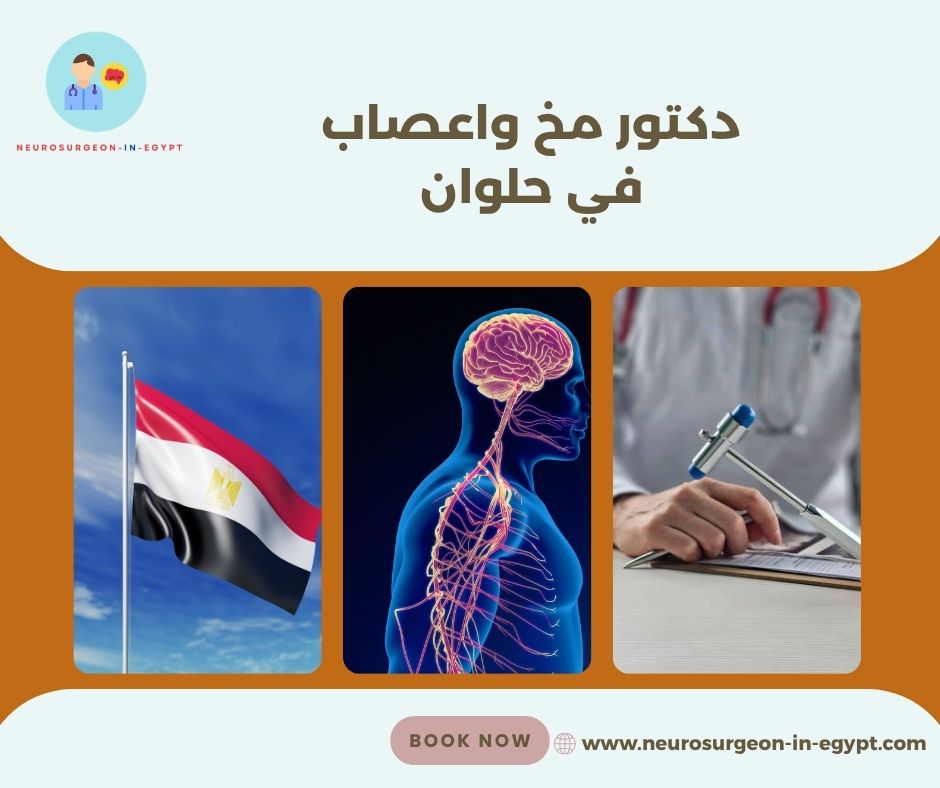 دكتور مخ واعصاب في حلوان
