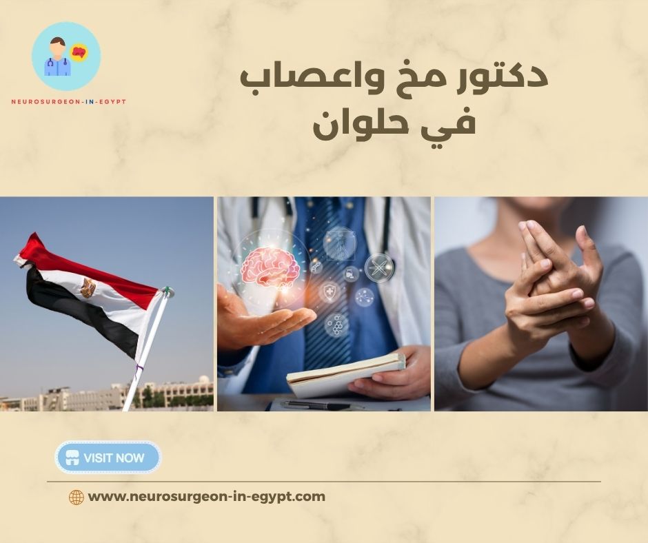دكتور مخ واعصاب في حلوان