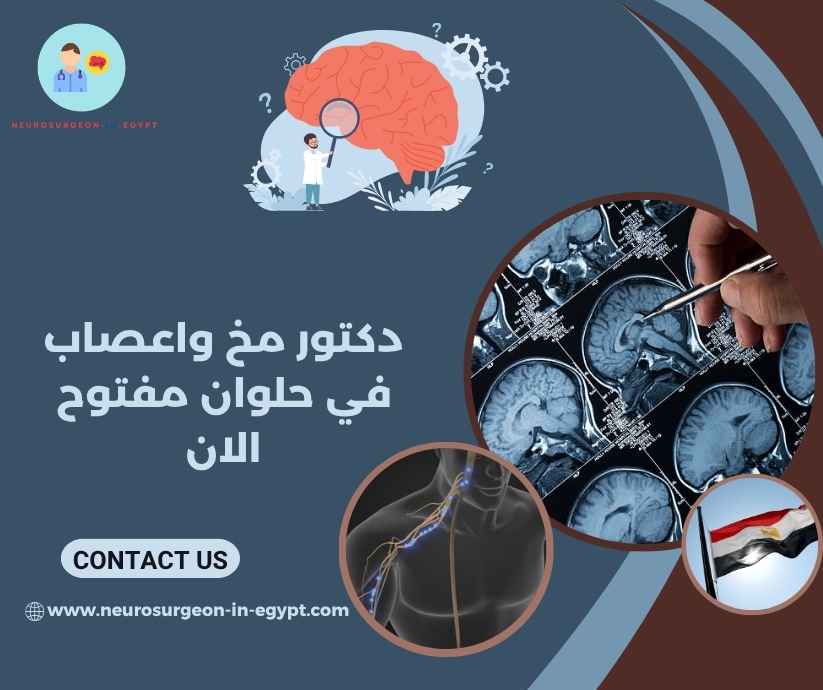دكتور مخ واعصاب في حلوان مفتوح الان