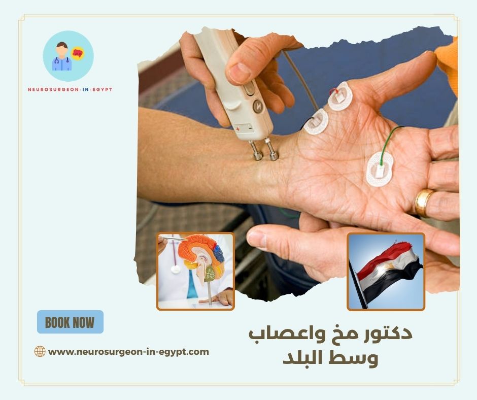 دكتور مخ واعصاب وسط البلد