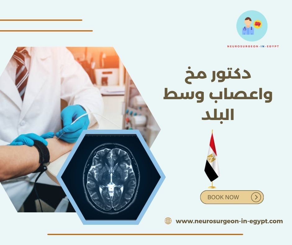دكتور مخ واعصاب وسط البلد