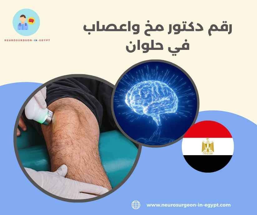رقم دكتور مخ واعصاب في حلوان