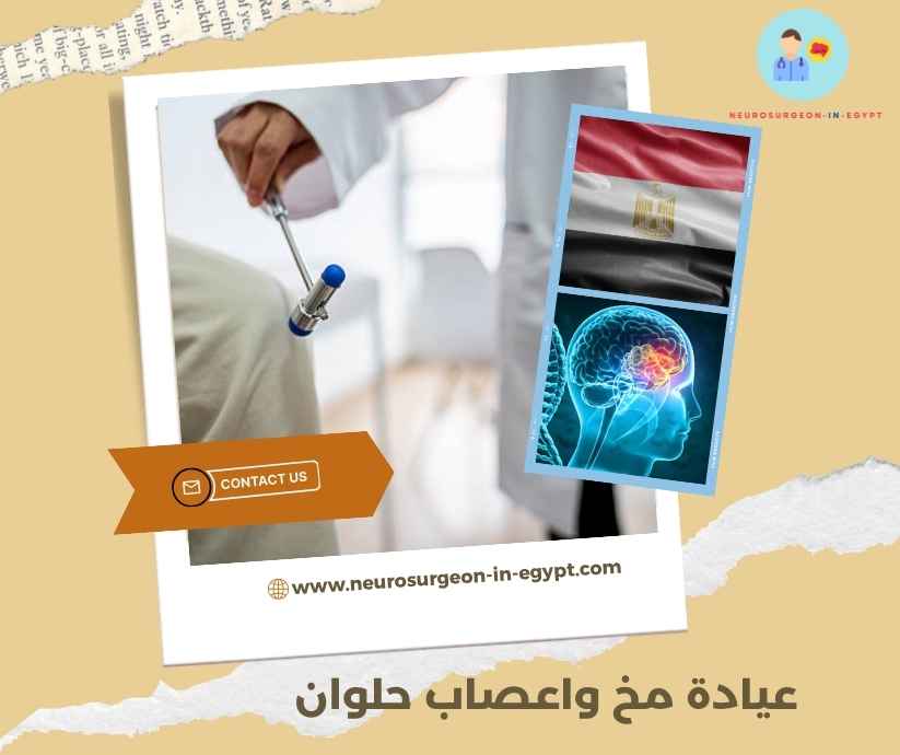 عيادة مخ واعصاب حلوان